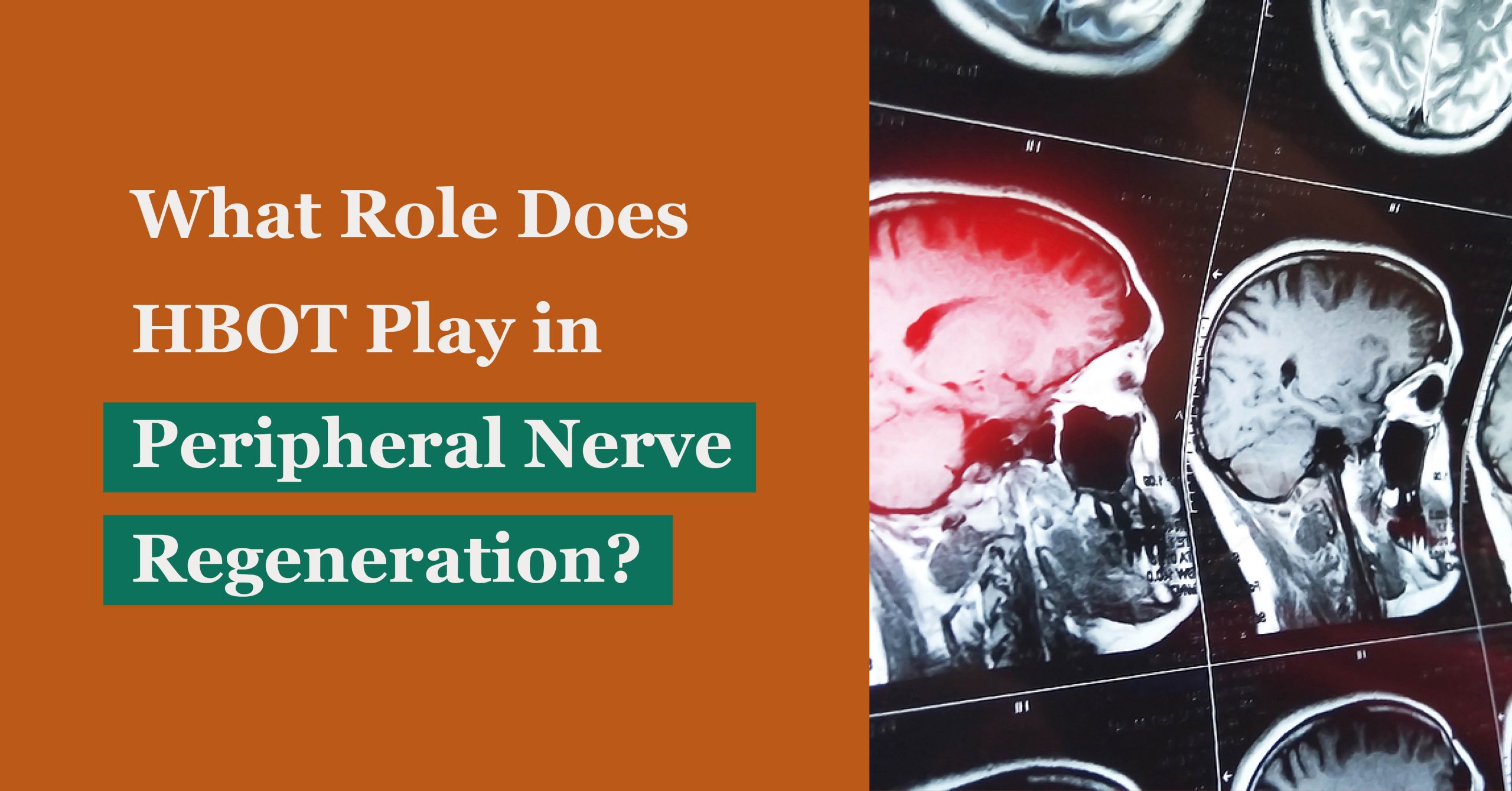 What Role Does HBOT Play in Peripheral Nerve Regeneration?